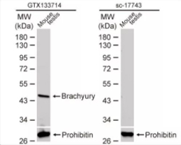 Brachyury antibody (GTX133714) Brachyury antibody (GTX133714)