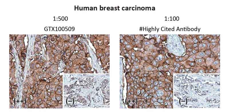 Her2 / ErbB2 antibody (GTX100509) Her2 / ErbB2 antibody (GTX100509)