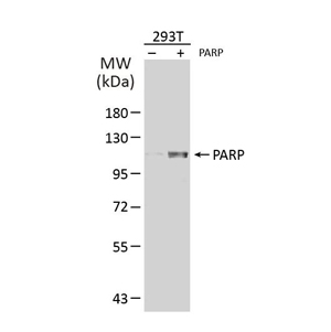 目标蛋白过表达 目标蛋白过表达