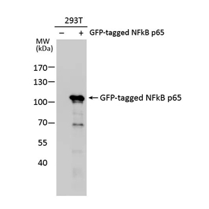 目标蛋白过表达 目标蛋白过表达