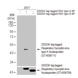 Respiratory Syncytial Virus type A Nucleoprotein antibody [HL1297] (GTX636711)