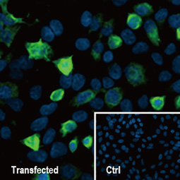 SARS-CoV-2 (COVID-19) nucleocapsid antibody SARS-CoV-2 (COVID-19) nucleocapsid antibody