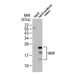 VEGF antibody (GTX132777) VEGF antibody (GTX132777)