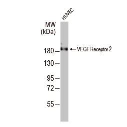 VEGF Receptor 2 antibody (GTX129943) VEGF Receptor 2 antibody (GTX129943)