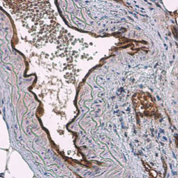 CD31 antibody (GTX130274) CD31 antibody (GTX130274)