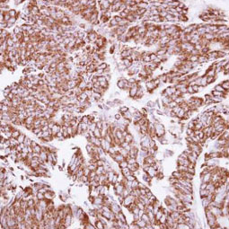 Angiopoietin 2 antibody (GTX100928) Angiopoietin 2 antibody (GTX100928)