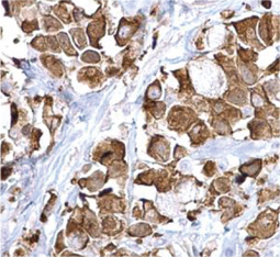 Fatty Acid Synthase antibody