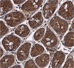 Pyruvate Dehydrogenase E1 beta subunit antibody