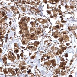 Integrin beta 1 / CD29 antibody (GTX128839) Integrin beta 1 / CD29 antibody (GTX128839)