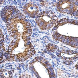 ALDH1A1 antibody (GTX123973) ALDH1A1 antibody (GTX123973)