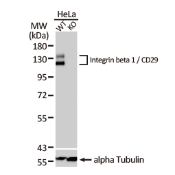 Integrin beta 1 / CD29 antibody (GTX128839) Integrin beta 1 / CD29 antibody (GTX128839)