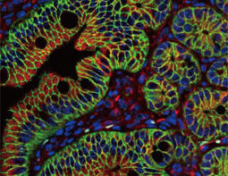 beta Catenin antibody