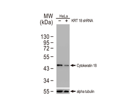 Cytokeratin 18 antibody
