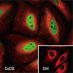 HIF1 alpha antibody HIF1 alpha antibody