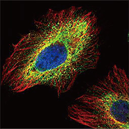 PHD1 antibody PHD1 antibody
