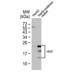 VEGF antibody VEGF antibody