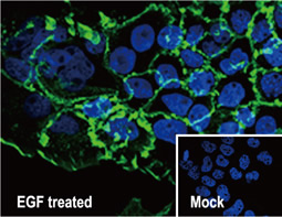 Phospho-EGF Receptor (Tyr1068) antibody