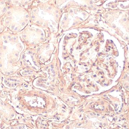 COL4A1 antibody [HL1351] (GTX636771)