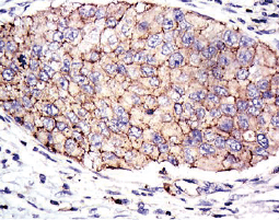 PAI-1 antibody [1D5] (GTX60537)