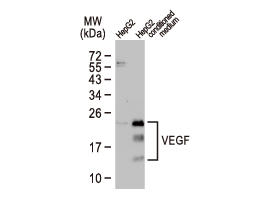 VEGF antibody (GTX132777)