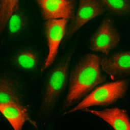 HMGB1 antibody (GTX101277)