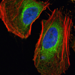 LDHA antibody (GTX101416)