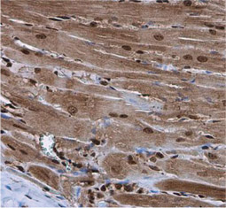 Nkx2.5 antibody GTX133155