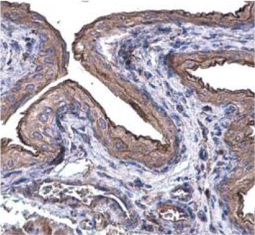 Cytokeratin 20 antibody [N2C2], Internal GTX110600