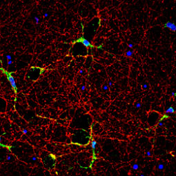 iNOS antibody (GTX130246) iNOS antibody (GTX130246)