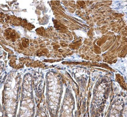 alpha Smooth Muscle Actin antibody (GTX100034)