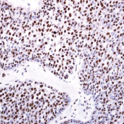 DNMT3B antibody (GTX129127) DNMT3B antibody (GTX129127)