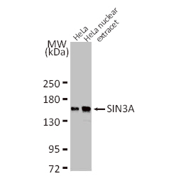 SIN3A antibody (GTX129156) SIN3A antibody (GTX129156)