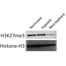 Histone H3K27me3 (Tri-methyl Lys27) antibody (GTX121184) Histone H3K27me3 (Tri-methyl Lys27) antibody (GTX121184)