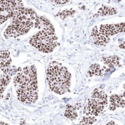 GATA3 antibody [MSVA-450M] HistoMAX™ (GTX04420)