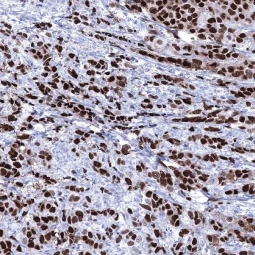 Progesterone Receptor antibody [MSVA-570R] HistoMAX™ (GTX04431)