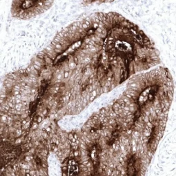CD66e antibody [MSVA-465R] HistoMAX™ (GTX04399)