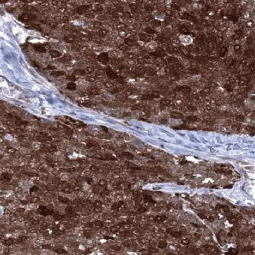 Cystatin A antibody [MSVA-461M] HistoMAX™ (GTX04453)