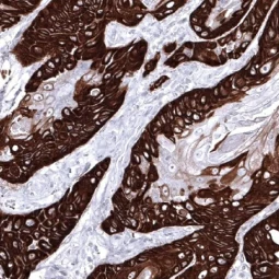 Cytokeratin 14 antibody [MSVA-614R] HistoMAX™ (GTX04377) 