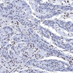 Ku80 antibody [MSVA-880M] HistoMAX™ (GTX04480)