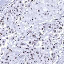 Nucleolin antibody [MSVA-623R] HistoMAX™ (GTX04456)