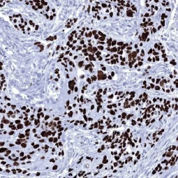 p63 antibody [MSVA-063R] HistoMAX™ (GTX04458)