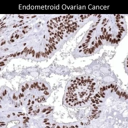 Estrogen Receptor alpha antibody [MSVA-564R] HistoMAX™ (GTX04474)