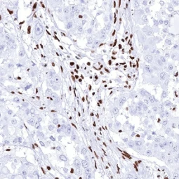 BRG1 antibody [MSVA-397R] HistoMAX™ (GTX04486) 