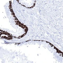 Cytokeratin 5 antibody [MSVA-605M] HistoMAX™ (GTX04402)