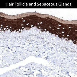 Cytokeratin 10 antibody [MSVA-610M] HistoMAX™ (GTX04401)