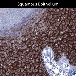 Desmoglein 1 antibody [MSVA-544M] HistoMAX™ (GTX04464)