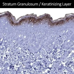 Kallikrein 7 antibody [MSVA-707M] HistoMAX™ (GTX04475)
