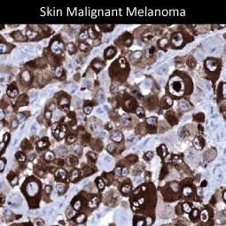 Melanoma gp100 antibody [MSVA-617R] HistoMAX™ (GTX04382)