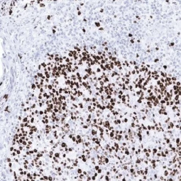 GTX04361 Ki67 antibody [MSVA-267M] HistoMAX™ (GTX04361)