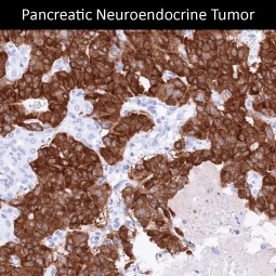 GAD65 antibody [MSVA-602M] HistoMAX™ (GTX04477)